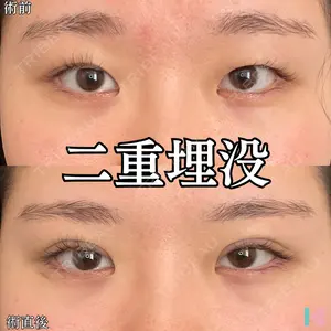 症例