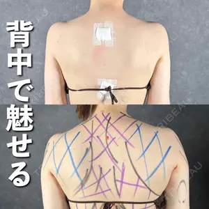 症例
