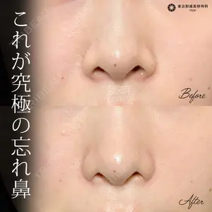 症例