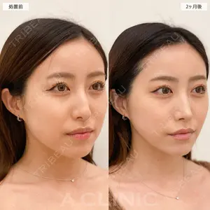 症例