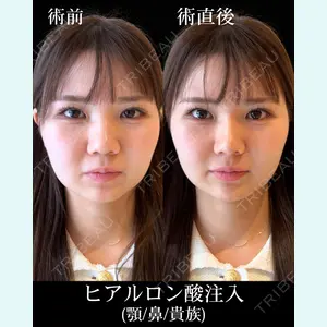 HAAB×DREAM BEAUTY CLINIC 東京本院 佐野 圭医師の症例