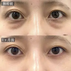 TCB東京中央美容外科 池袋駅前院 村田 大典医師の症例