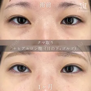 症例