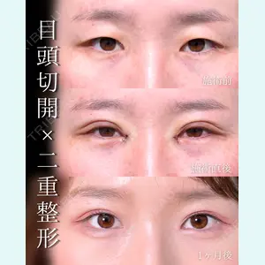 症例