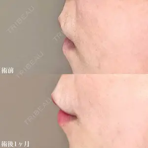 TCB東京中央美容外科 金沢院 佐藤 直弥医師の症例