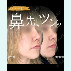 症例