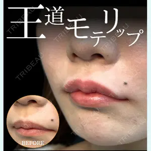 症例