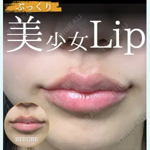 症例
