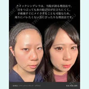 症例