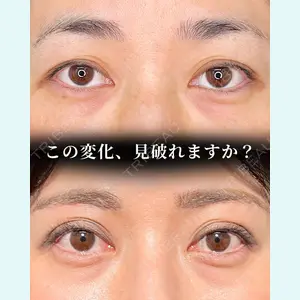 症例