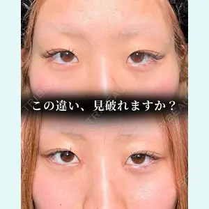 症例