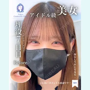 症例