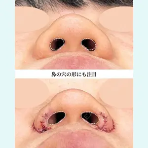 症例