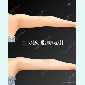 症例