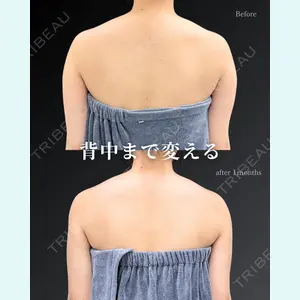 症例
