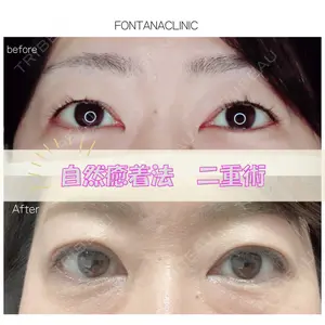 症例
