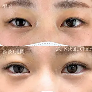 症例