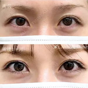 症例