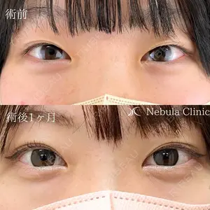症例