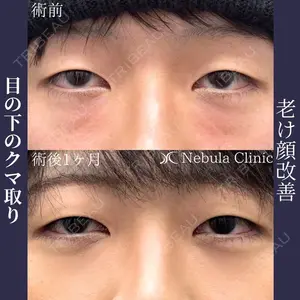 症例