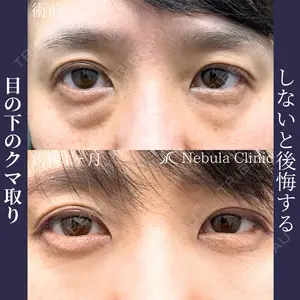 ネビュラクリニック 広島院の症例
