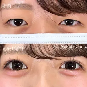 ネビュラクリニック 京都院の症例