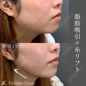 小倉美容外科ネビュラクリニックの症例