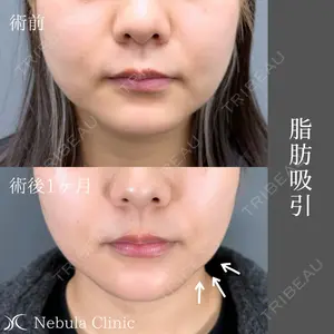 小倉美容外科ネビュラクリニックの症例