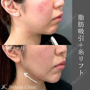 小倉美容外科ネビュラクリニックの症例
