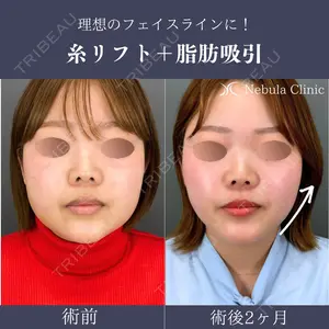 小倉美容外科ネビュラクリニックの症例