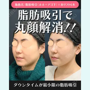 湘南美容クリニック 川崎院 伊藤 賀敏医師の症例