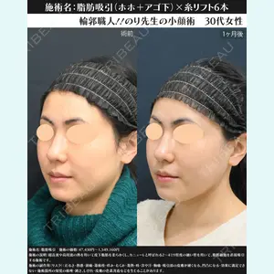 湘南美容クリニック 川崎院 伊藤 賀敏医師の症例