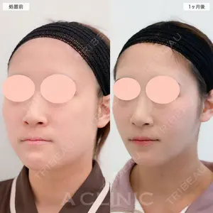 症例