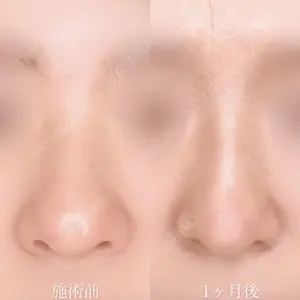 TCB東京中央美容外科 熊本院 垣花 瑠美子医師の症例