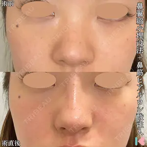 症例