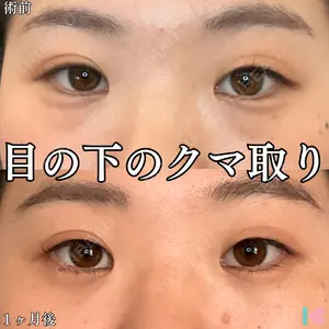 症例