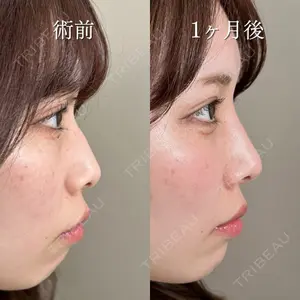 TCB東京中央美容外科 姫路院の症例