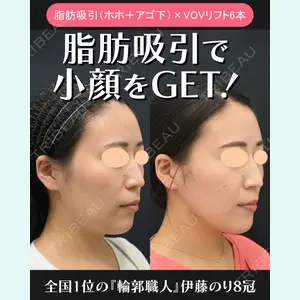 湘南美容クリニック 川崎院 伊藤 賀敏医師の症例