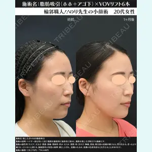 湘南美容クリニック 川崎院 伊藤 賀敏医師の症例