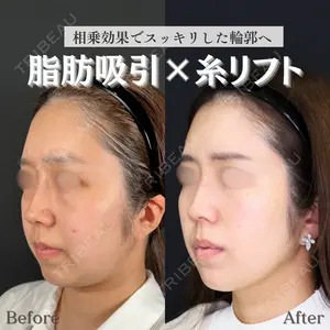 症例