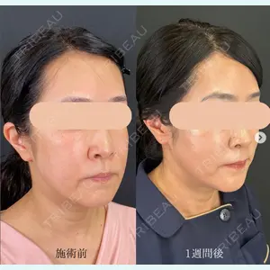 自由が丘ウェルエイジングビューティークリニックの症例