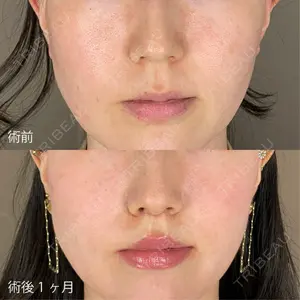 TCB東京中央美容外科 青森院の症例