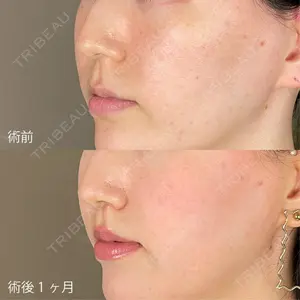 TCB東京中央美容外科 青森院の症例