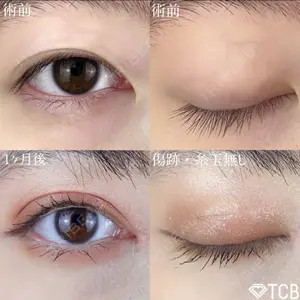 TCB東京中央美容外科 四日市院の症例