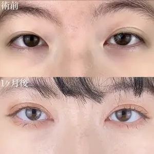 TCB東京中央美容外科 四日市院の症例