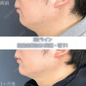 TCB東京中央美容外科 福山院 大隈 宏通医師の症例