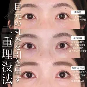 症例