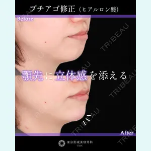 症例