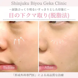 症例