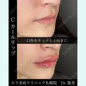 症例